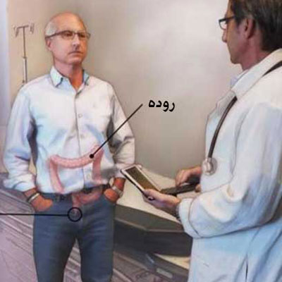 آیا فیستول خطرناک است؟