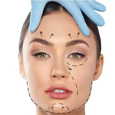 آیا لیفت با نخ دائمی است؟